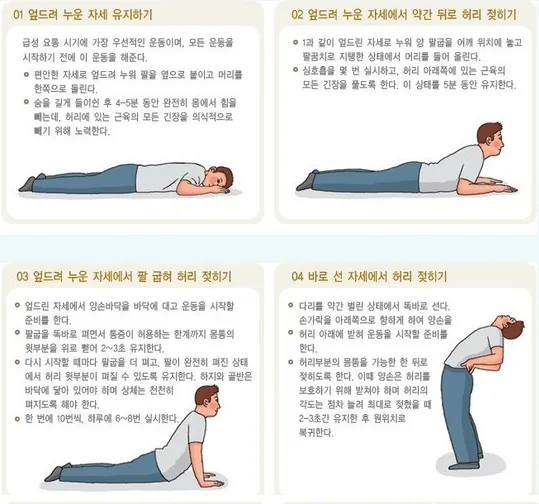 급성 요통 완화를 위한 3단계 엎드려 허리 젖히기 운동 가이드