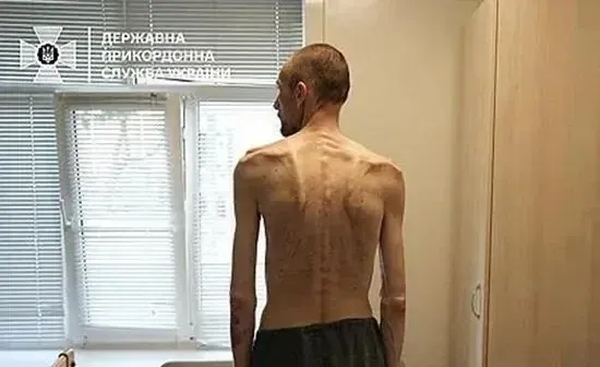 2년간 포로 생활 후 귀환한 우크라이나 병사의 쇠약해진 모습