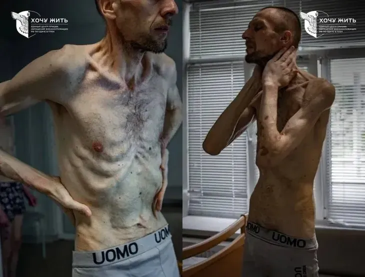 2년간 포로 생활 후 귀환한 우크라이나 병사의 쇠약해진 모습