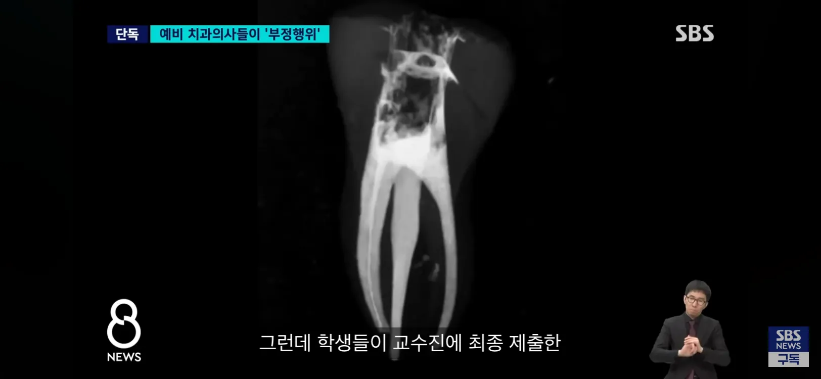 예비 치과의사들의 부정행위 관련 뉴스 기사 헤드라인