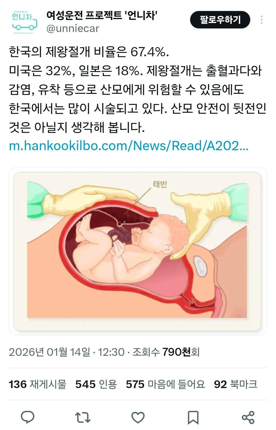 한국 제왕절개 비율 67.4%로 미국·일본보다 높다는 통계 이미지