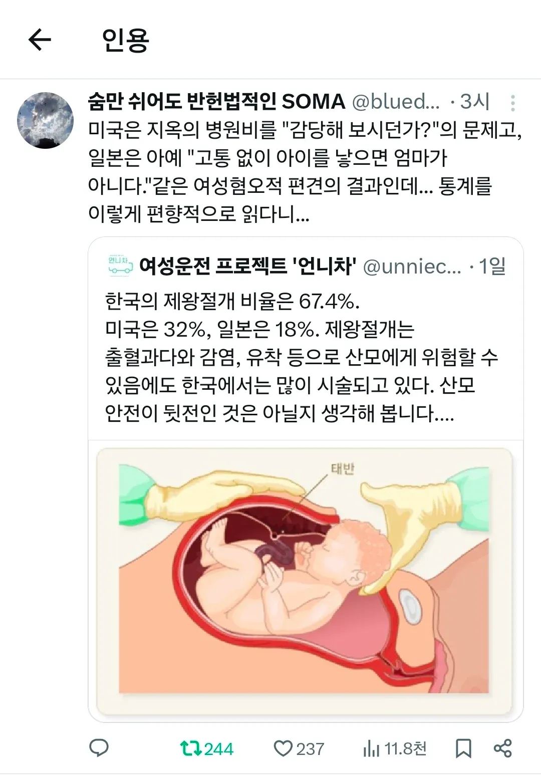 제왕절개 비율 통계를 비판하는 SNS 게시물과 인용 트윗