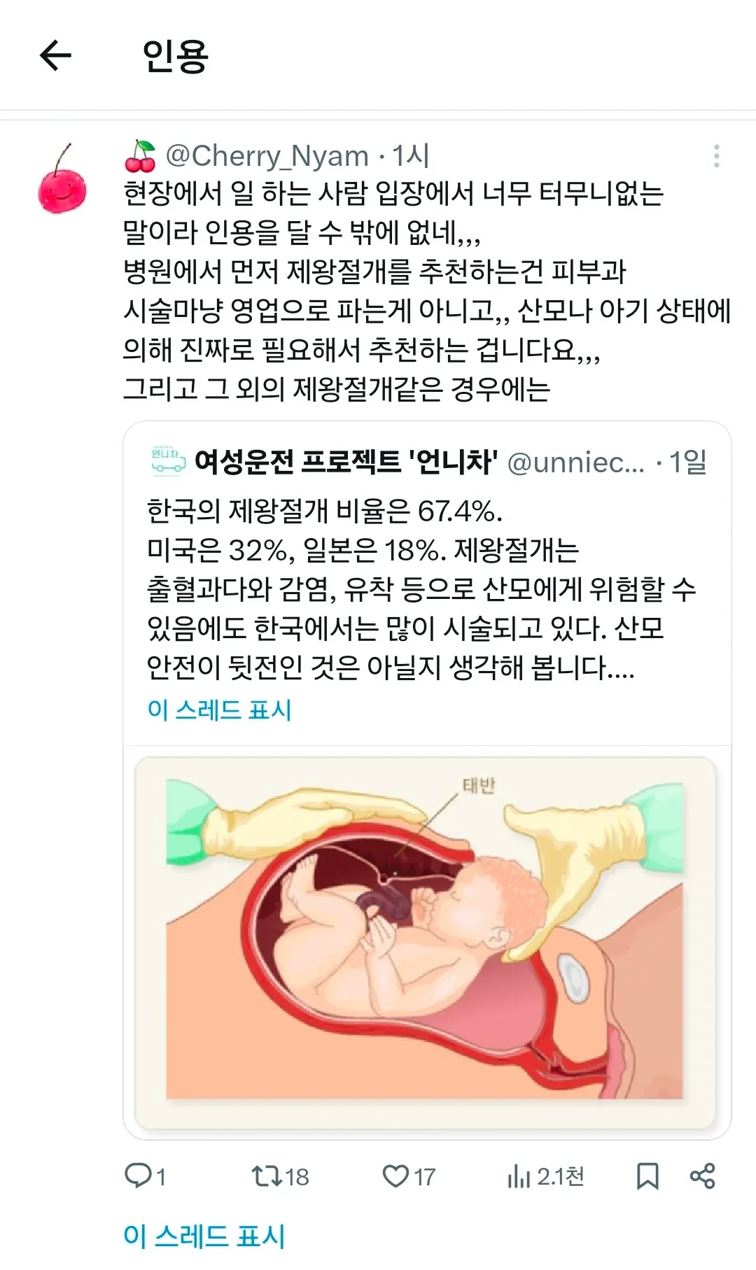 한국 제왕절개 비율 67.4%를 비판하는 트윗과 이에 반박하는 의료인 인용 트윗