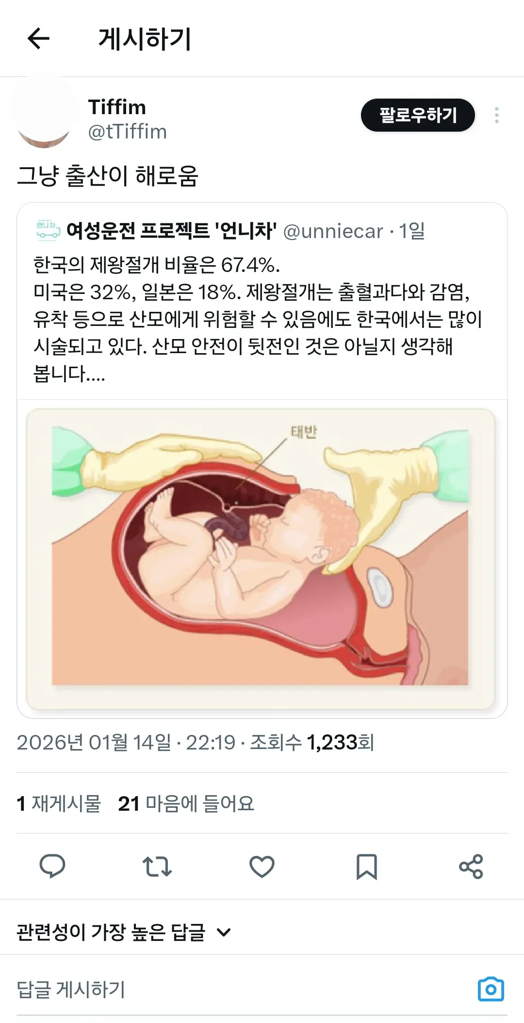 한국 제왕절개 비율 67.4%를 미국, 일본과 비교하며 산모 안전 우려를 제기하는 트윗 스크린샷