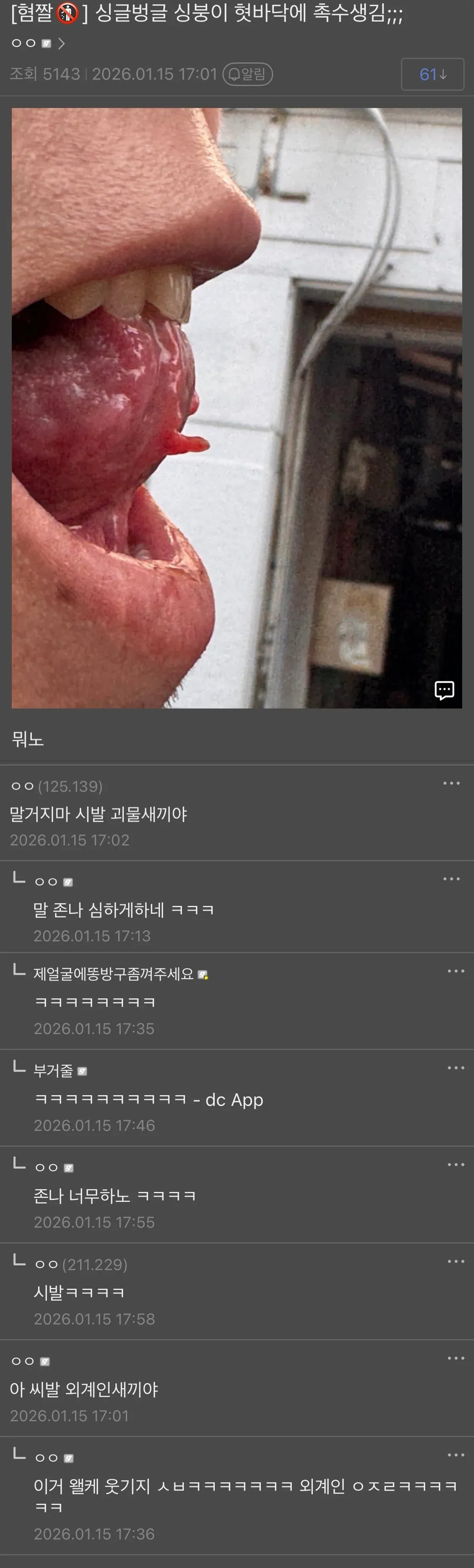 혀 밑에 술꽃 모양 돌기가 생긴 사람의 입 사진과 디시인사이드 댓글 반응