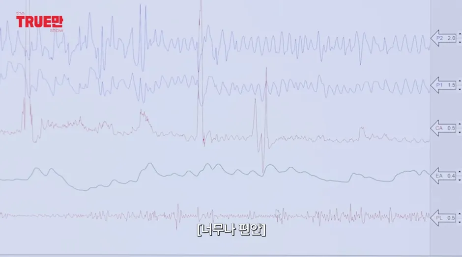 나루나 펑왕 - 유재석 똥꼬 헐꺼 같다는 정준하 근황