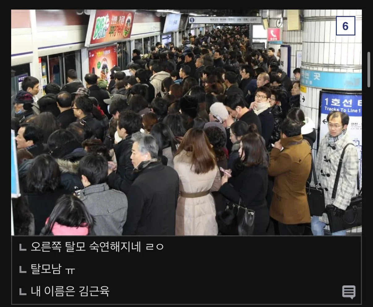 서울 중소기업 취업 후 스트레스로 탈모가 온 지방 출신 직장인의 현실을 보여주는 짤