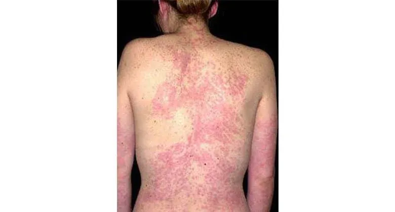 약물 위험성 안내 페이지 제목 영역