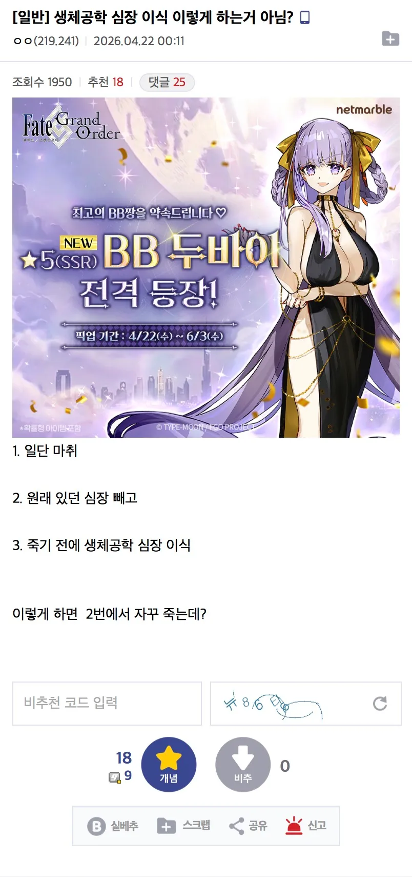 심장 이식 게임플레이 중 사망 반복 문제 게시글