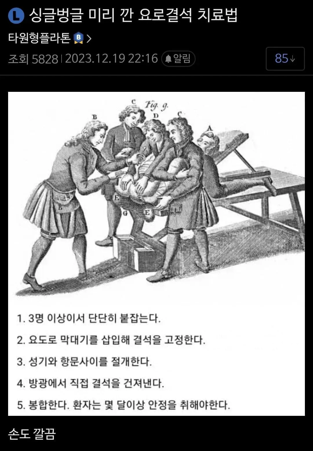 옛날 요로결석 수술의 5단계 절차 및 회복 정보