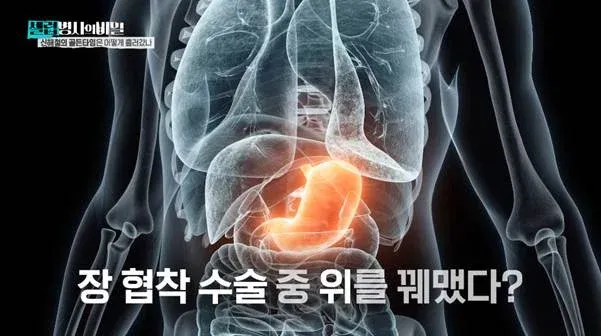 수술 중 사망 환자 5명 관련 신해철 집도의 보도