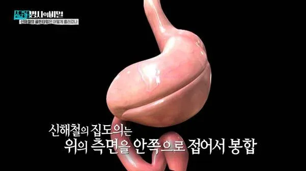 신해철 집도의 수술 중 사망 환자 5명 관련 뉴스 기사