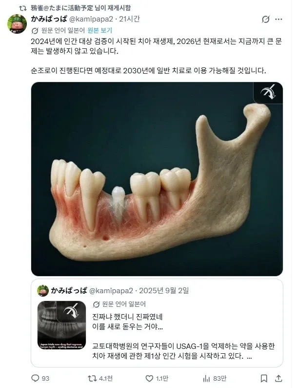 일본 치아 재생제 임상시험 진행 상황 댓글