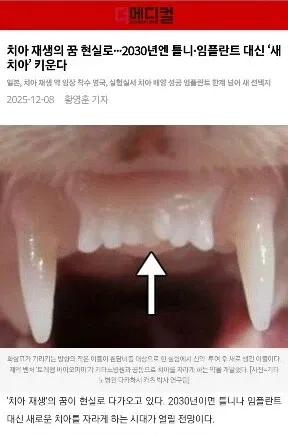일본 치아 재생 기술 2030년 현황