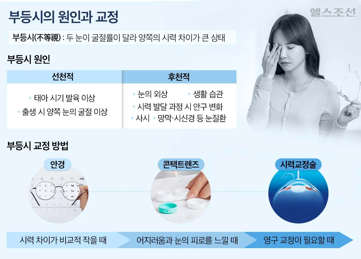 부등시(양쪽 눈 시력 차이) 원인과 안경, 콘택트렌즈, 시력교정술 교정 방법