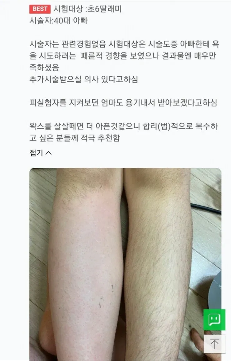 초6 딸 왁싱 시술 후기 댓글 스크린샷