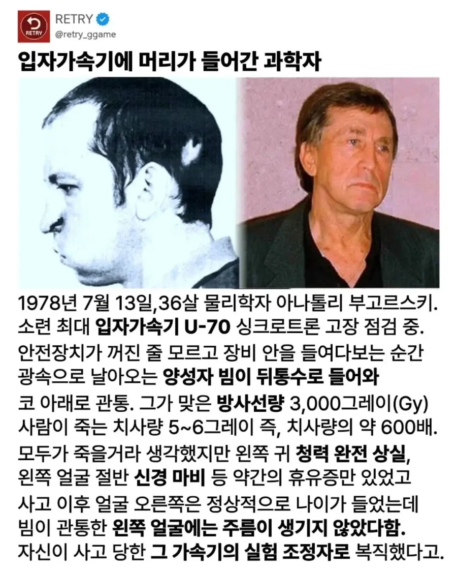 입자가속기 사고로 극도 피폭 후 생존한 과학자