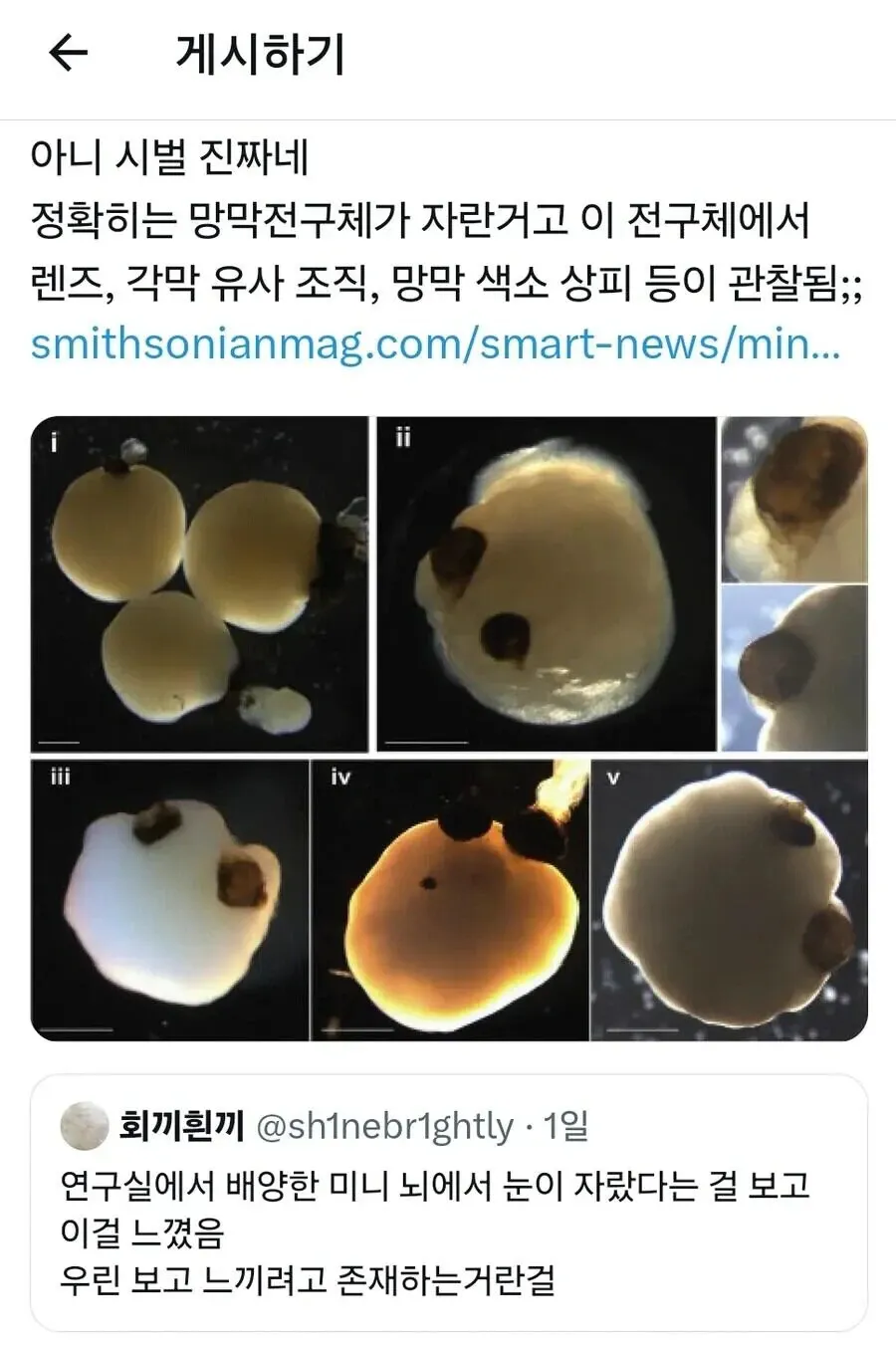 미니 뇌 배양 실험에서 눈 조직이 자라난 현상에 관한 한국어 댓글 캡처