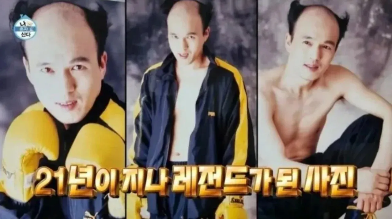 머리카락 이식 관련 이미지의 alt 태그입니다:

머리카락 이식한 모습