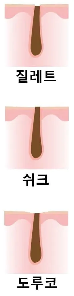 질렛, 쉬크, 도루코 면도날 3종의 면도 후 느낌 비교