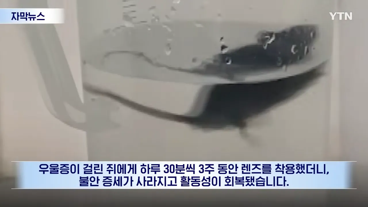 콘택트 렌즈로 우울증 치료, 불안 증상 완화 및 활동성 회복