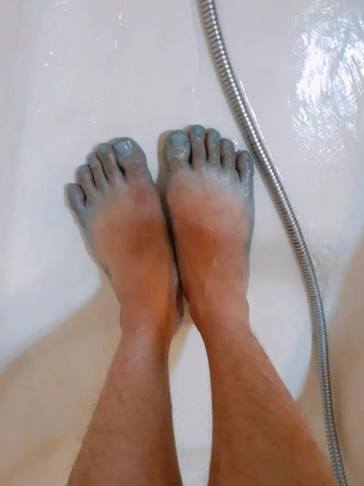 리스테린으로 무좀 제거를 시도하며 웃는 모습