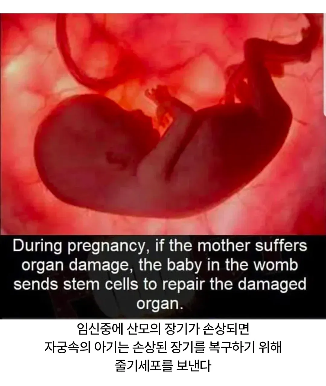 임신 중 손상된 산모 장기를 치료하는 태아의 줄기세포