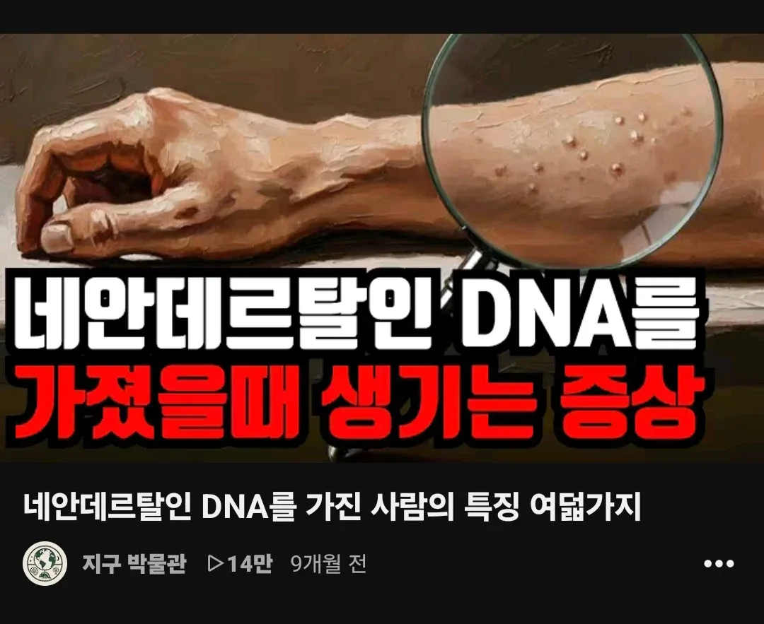 네안데르탈인 DNA를 가진 사람의 특징을 소개하는 영상 썸네일