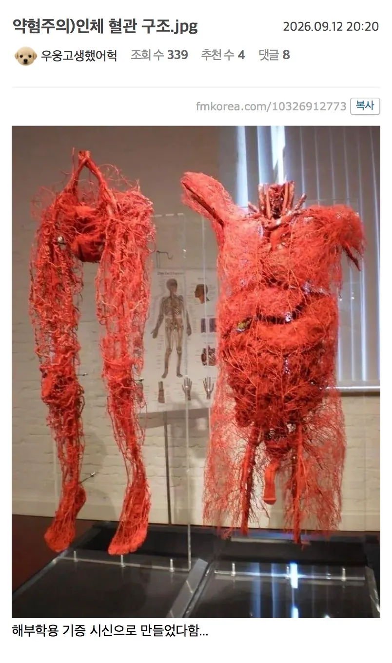 해부학용 기증 시신의 인체 혈관 구조 해부 이미지