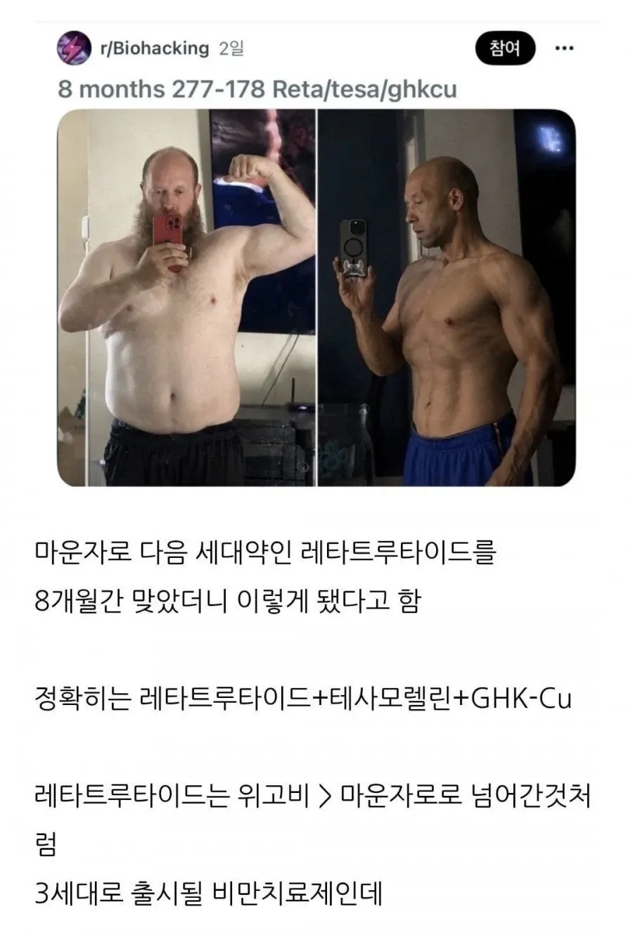 레타트루타이드 등 사용 8개월 후 277→178파운드 체중 변화를 보여주는 게시물