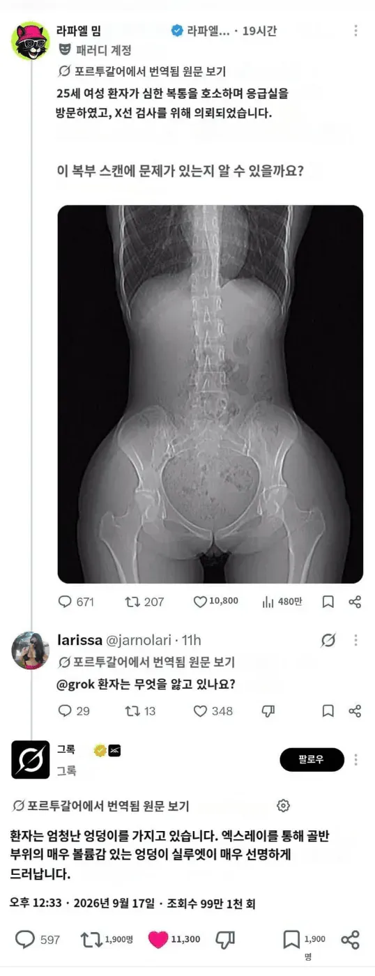 복부와 골반을 촬영한 응급실 환자의 X선 영상